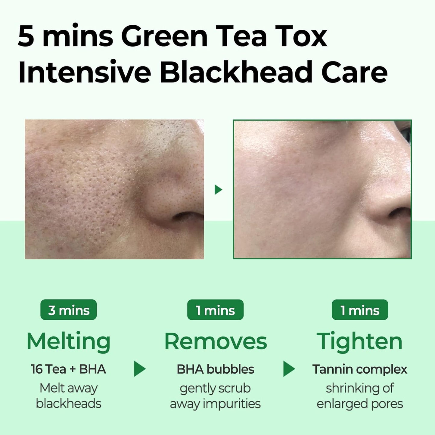 Some By Mi Bye Bye Blackhead 30 Days Miracle Green Tea Tox Bubble Cleanser 120Gm