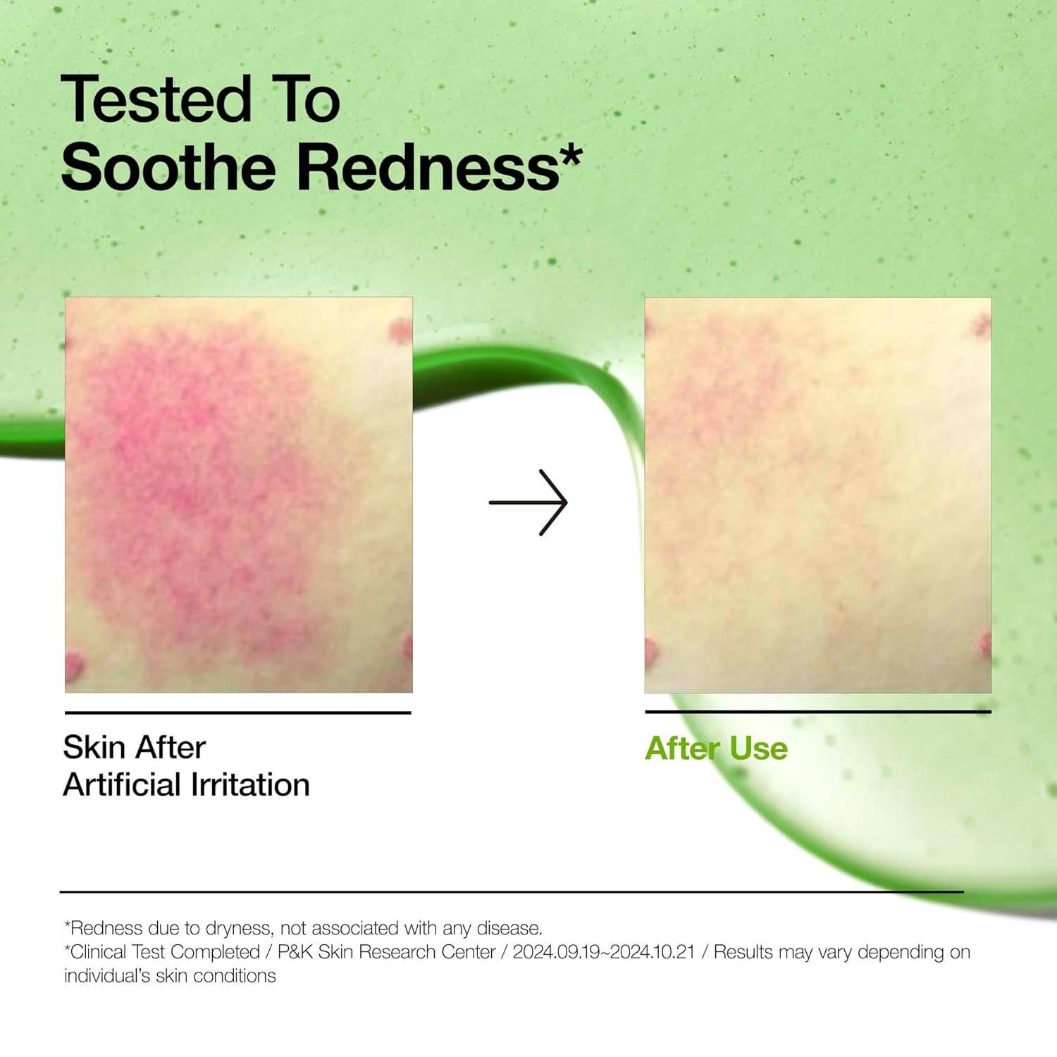 Anua Azelaic Acid 10 + Hyaluron Redness Soothing Serum 30Ml