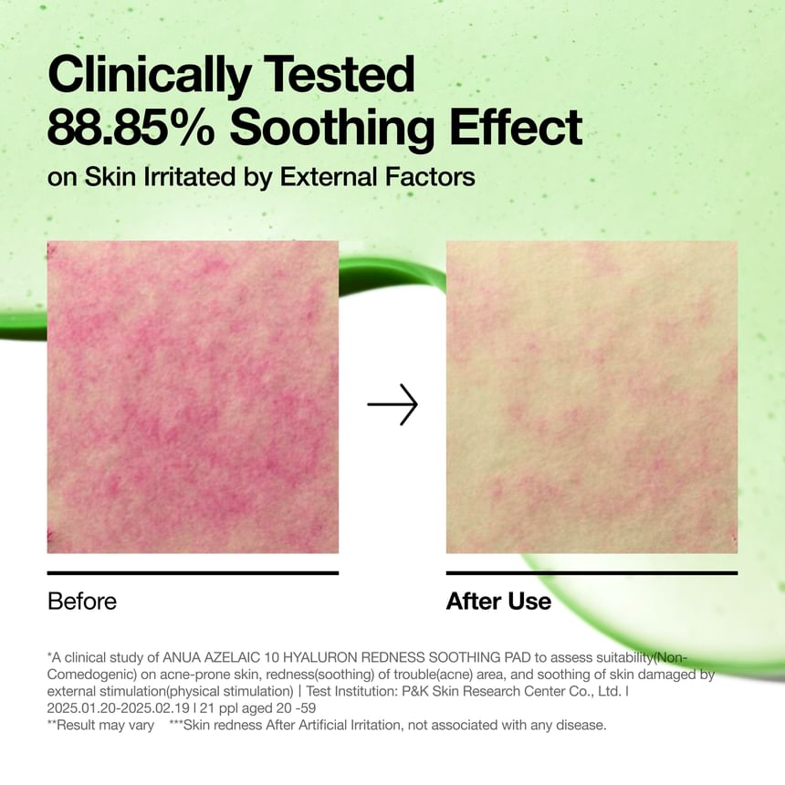 Anua Soothing Azelaic10+Hyaluaron Pad 230Ml/90Pads